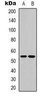 Western blot analysis of CHRNA9 expression in Jurkat (A); HEK293T (B) whole cell lysates.