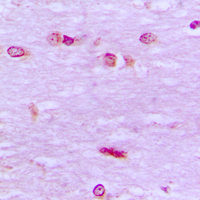 Immunohistochemical analysis of BRF1 staining in human brain formalin fixed paraffin embedded tissue section. The section was pre-treated using heat mediated antigen retrieval with sodium citrate buffer (pH 6.0). The section was then incubated with the antibody at room temperature and detected using an HRP conjugated compact polymer system. DAB was used as the chromogen. The section was then counterstained with haematoxylin and mounted with DPX.