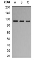 Western blot analysis of Complement C7 expression in HepG2 (A); K562 (B); mouse lung (C) whole cell lysates.