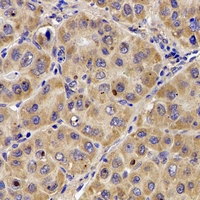 Immunohistochemical analysis of Complement C7 staining in human liver formalin fixed paraffin embedded tissue section. The section was pre-treated using heat mediated antigen retrieval with sodium citrate buffer (pH 6.0). The section was then incubated with the antibody at room temperature and detected using an HRP conjugacompact polymer system. DAB was used as the chromogen. The section was then counterstained with haematoxylin and mounted with DPX.