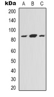 Western blot analysis of NOXIN expression in HEK293T (A); Hela (B); HepG2 (C) whole cell lysates.