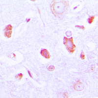 Immunohistochemical analysis of GUCY1A3 staining in human brain formalin fixed paraffin embedded tissue section. The section was pre-treated using heat mediated antigen retrieval with sodium citrate buffer (pH 6.0). The section was then incubated with the antibody at room temperature and detected using an HRP conjugated compact polymer system. DAB was used as the chromogen. The section was then counterstained with haematoxylin and mounted with DPX.