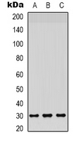 Western blot analysis of CD66c/d expression in HepG2 (A); A549 (B); mouse brain (C) whole cell lysates.