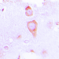 Immunohistochemical analysis of GUCY1B3 staining in human brain formalin fixed paraffin embedded tissue section. The section was pre-treated using heat mediated antigen retrieval with sodium citrate buffer (pH 6.0). The section was then incubated with the antibody at room temperature and detected using an HRP conjugated compact polymer system. DAB was used as the chromogen. The section was then counterstained with haematoxylin and mounted with DPX.