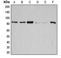 Western blot analysis of GYS1 expression in SW626 (A); SKOV3 (B); HeLa (C); K562 (D); HepG2 (E); mouse liver (F) whole cell lysates.