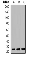 Western blot analysis of TP53INP2 expression in SHSY5Y (A); HEK293T (B); mouse kidney (C) whole cell lysates.