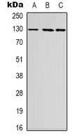 Western blot analysis of FOG2 expression in Hela (A); HEK293T (B); HepG2 (C) whole cell lysates.