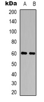 Western blot analysis of CHRM5 expression in LOVO (A); Raw264.7 (B) whole cell lysates.