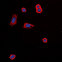 Immunofluorescent analysis of MC5 Receptor staining in MCF7 cells. Formalin-fixed cells were permeabilized with 0.1% Triton X-100 in TBS for 5-10 minutes and blocked with 3% BSA-PBS for 30 minutes at room temperature. Cells were probed with the primary antibody in 3% BSA-PBS and incubated overnight at 4 deg C in a hidified chamber. Cells were washed with PBST and incubated with a DyLight 594-conjugated secondary antibody (red) in PBS at room temperature in the dark. DAPI was used to stain the cell nuclei (blue).