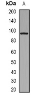 Western blot analysis of Collagen 1 alpha 2 expression in Jurkat (A) whole cell lysates.