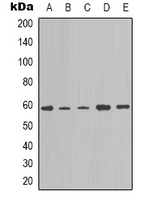 Western blot analysis of NOTCH4 expression in A549 (A); K562 (B); Hela (C); mouse brain (D); NIH3T3 (E) whole cell lysates.