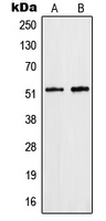Western blot analysis of hnRNP F expression in HepG2 (A); Jurkat (B) whole cell lysates.