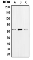 Western blot analysis of hnRNP K (pS284) expression in MCF7 EGF-treated (A); Raw264.7 EGF-treated (B); H9C2 EGF-treated (C) whole cell lysates.