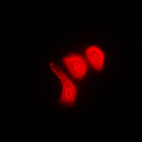 Immunofluorescent analysis of hnRNP K (pS284) staining in Raw264.7 cells. Formalin-fixed cells were permeabilized with 0.1% Triton X-100 in TBS for 5-10 minutes and blocked with 3% BSA-PBS for 30 minutes at room temperature. Cells were probed with the primary antibody in 3% BSA-PBS and incubated overnight at 4 C in a humidified chamber. Cells were washed with PBST and incubated with a DyLight 594-conjugated secondary antibody (red) in PBS at room temperature in the dark. DAPI was used to stain the cell nuclei (blue).