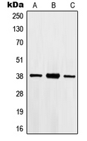 Western blot analysis of HOXB2 expression in Jurkat (A); HepG2 (B); A549 (C) whole cell lysates.