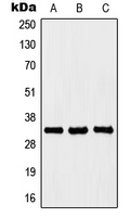 Western blot analysis of HOXB4 expression in Jurkat (A); K562 (B); PC12 (C) whole cell lysates.