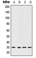 Western blot analysis of HOXC12 expression in MCF7 (A); ACHN (B); NIH3T3 (C); PC12 (D) whole cell lysates.