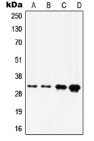 Western blot analysis of HOXD8 expression in A375 (A); A431 (B); HepG2 (C); HeLa (D) whole cell lysates.