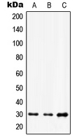 Western blot analysis of HOXD12 expression in A549 (A); HuvEc (B); NIH3T3 (C) whole cell lysates.