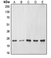 Western blot analysis of ERAS expression in HeLa (A); Jurkat (B); mouse liver (C); PC12 (D); rat kidney (E) whole cell lysates.