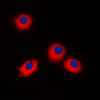 Immunofluorescent analysis of ERAS staining in Jurkat cells. Formalin-fixed cells were permeabilized with 0.1% Triton X-100 in TBS for 5-10 minutes and blocked with 3% BSA-PBS for 30 minutes at room temperature. Cells were probed with the primary antibody in 3% BSA-PBS and incubated overnight at 4 C in a humidified chamber. Cells were washed with PBST and incubated with a DyLight 594-conjugated secondary antibody (red) in PBS at room temperature in the dark. DAPI was used to stain the cell nuclei (blue).