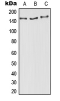 Western blot analysis of Aldehyde Oxidase expression in MCF7 (A); SP2/0 (B); PC12 (C) whole cell lysates.