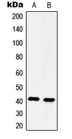 Western blot analysis of 5-HT4 expression in HeLa (A); Jurkat (B) whole cell lysates.