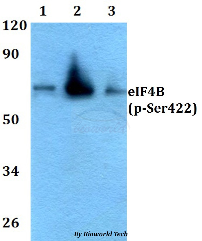 Western blot (WB) analysis of p-eIF4B (Ser422) pAb at 1:500 dilution Lane1:HEK293T whole cell lysate Lane2:Raw264.7 whole cell lysate Lane3:PC12 whole cell lysate