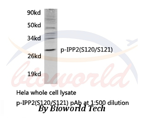 Western blot (WB) analysis of p-IPP2 (S120/S121) pAb in extracts from Hela cells.