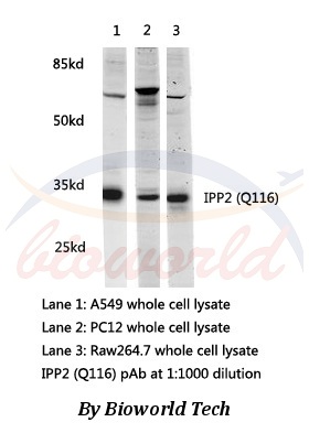 Western blot (WB) analysis of IPP2 (Q116) pAb in extracts from A549, PC12 and Raw264.7 cells.