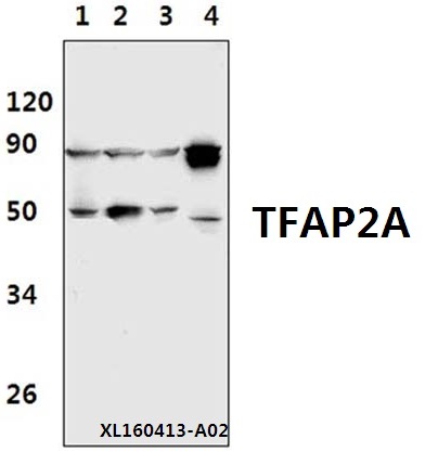 Western blot (WB) analysis of TFAP2A (K431) pAb at 1:500 dilution Lane1:Hela whole cell lysate(40ug) Lane2:MCF-7 whole cell lysate(40ug) Lane3:H9C2 whole cell lysate(40ug) Lane4:The Brain tissue lysate of Mouse(40ug)