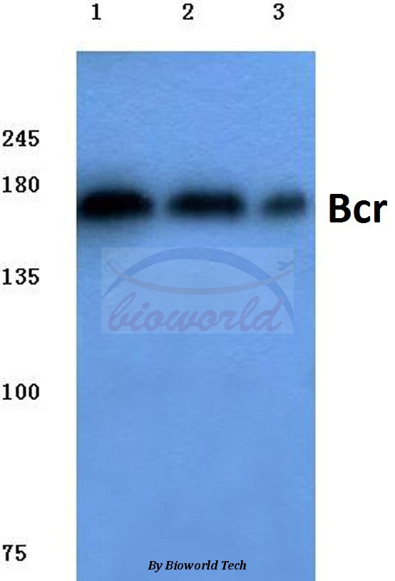 Western blot (WB) analysis of Bcr (D171) pAb at 1:500 dilution Lane1:HepG2 cell lysate Lane2:Mouse brain tissue lysate Lane3:Rat brain tissue lysate
