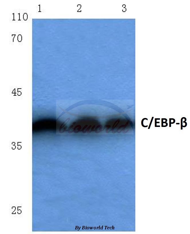 Western blot (WB) analysis of C/EBP-β (S229/182) pAb at 1:500 dilution Lane1:Hela cell lysate Lane2:Mouse brain tissue lysate Lane3:Rat kidney tissue lysate