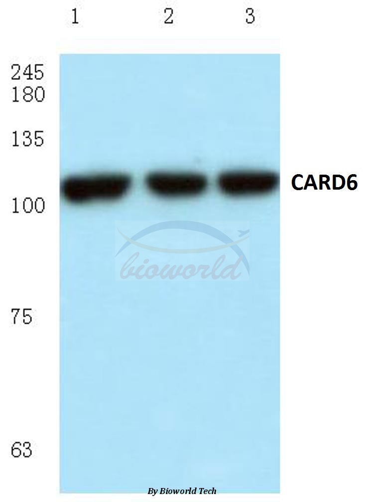 Western blot (WB) analysis of CARD6/CINCIN1 (A2) pAb in extracts from HeLa cells.