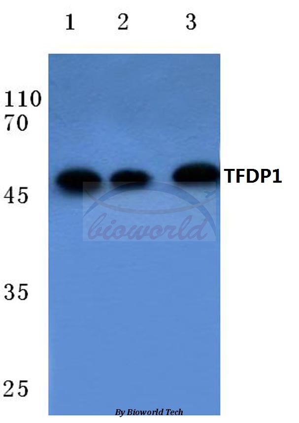 Western blot (WB) analysis of TFDP1 (V393) pAb at 1:500 dilution Lane1:HEK293T cell lysate Lane2:Mouse heart tissue lysate Lane3:PC12 cell lysate