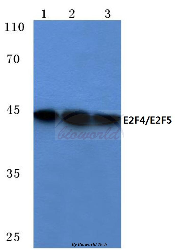 Western blot (WB) analysis of E2F4/E2F5 (L50/83) pAb at 1:500 dilution Lane1:Hela cell lysate Lane2:HEK293T cell lysate Lane3:Mouse kidney tissue lysate
