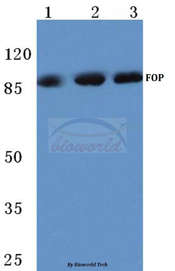Western blot (WB) analysis of FGFR1 OP (N371) pAb at 1:500 dilution Lane1:HEK293T cell lysate Lane2:Mouse brain tissue lysate Lane3:Rat brain tissue lysate