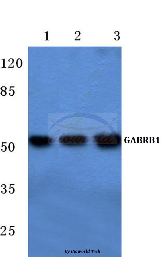 Western blot (WB) analysis of GABAA Rβ1 (R328) pAb at 1:500 dilution Lane1:MCF-7 cell lysate Lane2:Mouse liver tissue lysate Lane3:Rat liver tissue lysate