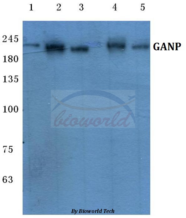 Western blot (WB) analysis of GANP (E1872) pAb at 1:500 dilution Lane1:Hela cell lysate Lane2:MCF-7 cell lysate Lane3:Raw264.7 cell lysate Lane4:Mouse liver tissue lysate Lane5:Rat kidney tissue lysate