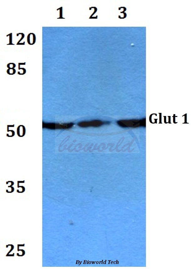 Western blot (WB) analysis of Glut 1 (G470) pAb at 1:500 dilution Lane1:HEK293T whole cell lysate Lane2:NIH-3T3 whole cell lysate Lane3:PC12 whole cell lysate