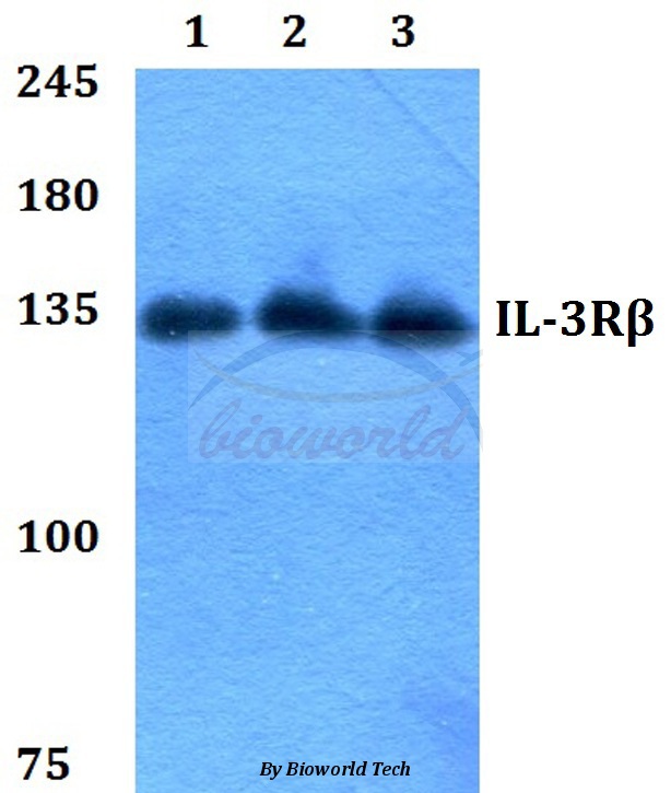 Western blot (WB) analysis of IL-3Rβ (F587) pAb at 1:500 dilution Lane1:HEK293T whole cell lysate Lane2:sp2/0 whole cell lysate Lane3:H9C2 whole cell lysate