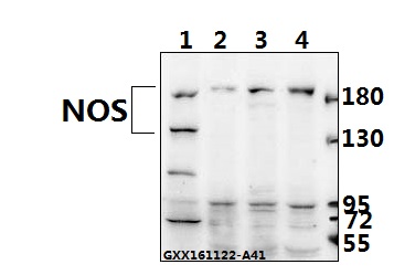 Western blot (WB) analysis of NOS2 (V1131) pAb at 1:500 dilution Lane1:AML-12 whole cell lysate(40ug) Lane2:HCC827 whole cell lysate(40ug) Lane3:L02 whole cell lysate(40ug) Lane4:HepG2 whole cell lysate(40ug)