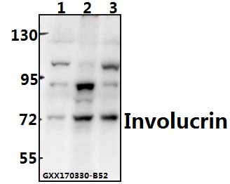 Western blot (WB) analysis of Involucrin (P568) pAb at 1:500 dilution Lane1:MCF-7 cell lysate Lane2:Mouse brain tissue lysate Lane3:Rat brain tissue lysate