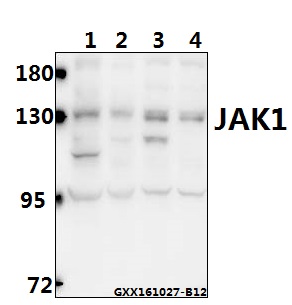 Western blot (WB) analysis of JAK1 (I1016) pAb at 1:500 dilution Lane1:DLD whole cell lysate(40ug) Lane2:U87MG whole cell lysate(40ug) Lane3:The Brain tissue lysate of Mouse(40ug) Lane4:The Brain tissue lysate of Rat(40ug)