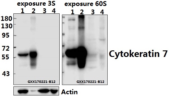 Western blot (WB) analysis of Cytokeratin 7 (L451) pAb at 1:500 dilution Lane1:Hela cell lysate Lane2:sp2/0 cell lysate Lane3:H9C2 cell lysate