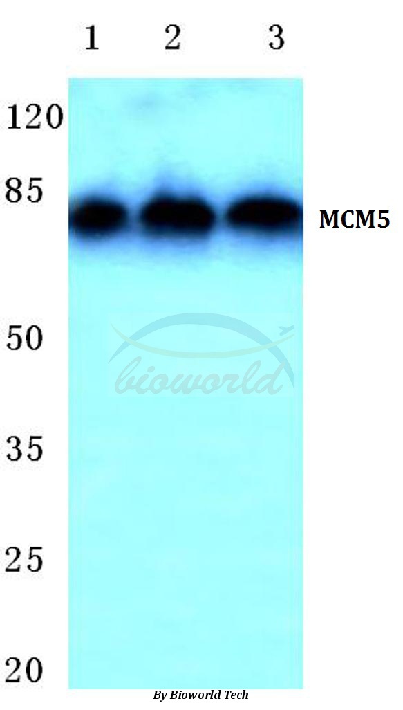 Western blot (WB) analysis of MCM5 (F51) pAb in extracts from HepG2 cells