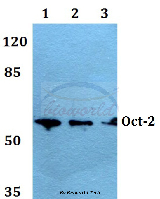 Western blot (WB) analysis of Oct-2 (H3) pAb at 1:500 dilution Lane1:HEK293T whole cell lysate Lane2:NIH-3T3 whole cell lysate Lane3:H9C2 whole cell lysate
