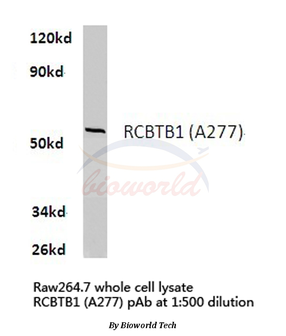 Western blot (WB) analysis of RCBTB1 (A277) pAb in extracts from raw264.7 cells.