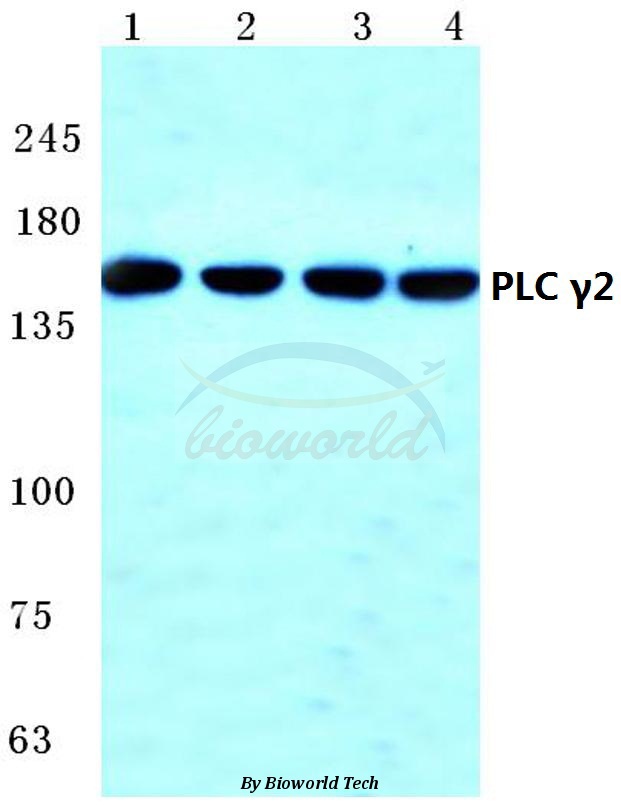 Western blot (WB) analysis of PLC γ2 (R747) pAb at 1:500 dilution Lane1:A549 cell lysate Lane2:NIH-3T3 cell lysate Lane3:Mouse brain tissue lysate Lane4:Rat brain tissue lysate