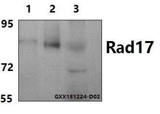 Western blot (WB) analysis of Rad17 (A639) pAb at 1:500 dilution Lane1:Hela whole cell lysate(40ug) Lane2:Jurkat whole cell lysate(40ug) Lane3:The heart tissue lysate of Rat(15ug)